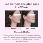 YBM Facial Lifting Device™ - YBM