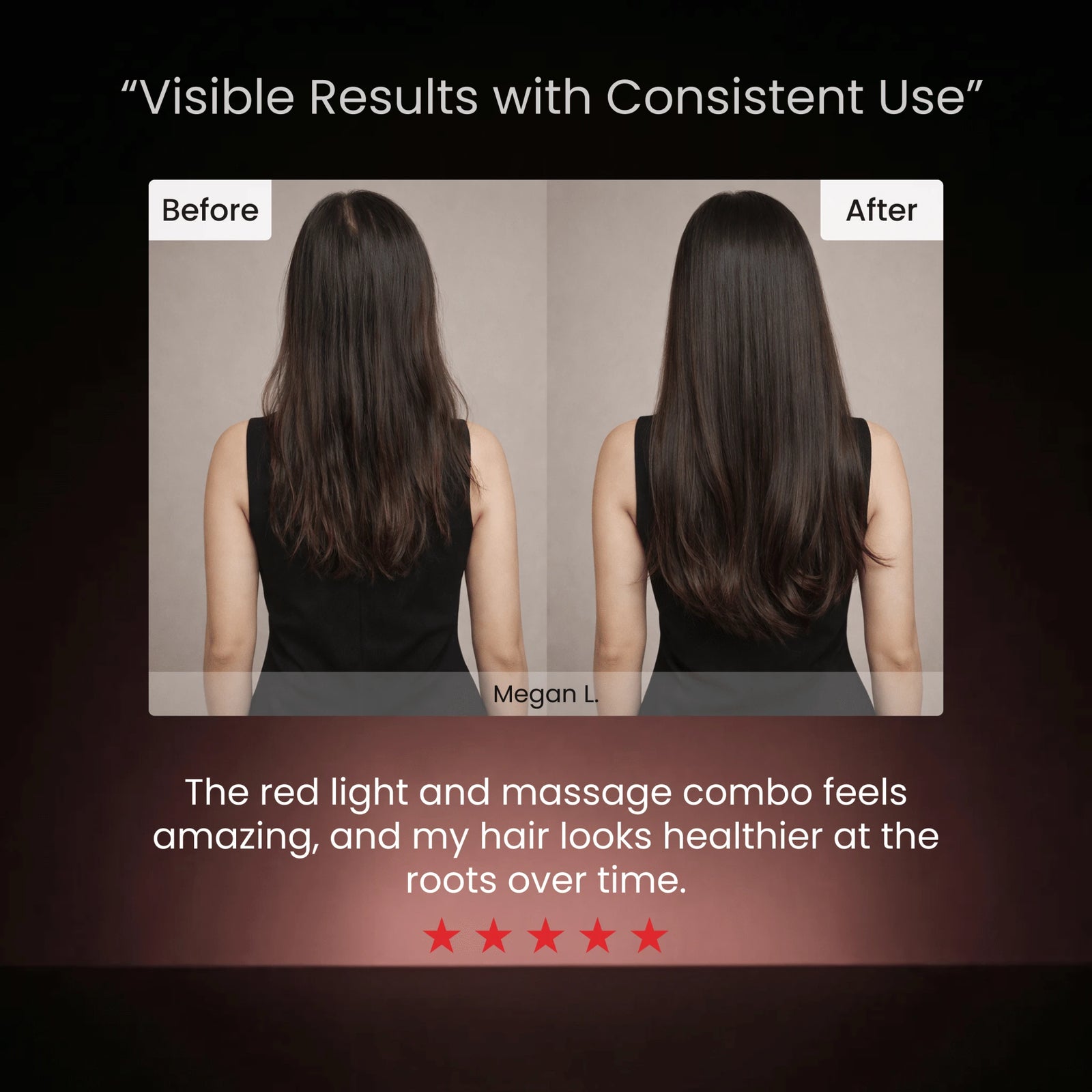 YBM 3-in-1 Red Light Hair Growth Therapy™